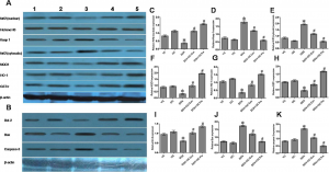 I3C induced Nrf2-mediated activation of ARE pathways as well as modulate the apoptotic/antiapoptotic pathways in bone marrow cells (A) Protein expression profile of Nrf2 (nuclear), Histone H3, Keap1, Nrf2 (cytosolic), NQO-1, HO-1, GSTπ and β-actin (B) Protein expression profile of Bcl-2, Bax, Caspase-3 and β-actin in mice bone marrow following different treatments. Lane 1: Vehicle-control group (VC), lane 2: only I3C-treated group (I3C), lane 3: only DOX-treated group (DOX), lane 4: DOX + I3C concomitant-treatment group (DOX + I3C Con), and lane 5: DOX + 3C pre-treatment group (DOX + I3C Pre). The bar diagrams showed relative band intensity of (C) Nrf2 (nuclear), (D) Keap1, (E) Nrf2 (cytosolic), (F) NQO-1, (G) HO-1, (H) GSTπ, (I) Bcl-2 (J) Bax and (K) Caspase-3. The results were normalized with Histone H3 for Nrf2 (nuclear), β-actin for Keap1, Nrf2 (cytosolic), NQO1, HO-1, GSTπ, Bcl-2, Bax and Caspase-3. Results were expressed as means ± SD, n = 6. *P < 0.05 statistically compared with vehicle control (VC) group and #P < 0.05 statistically compared with DOX-treated group (DOX) (one-way ANOVA followed by Tukey’s post hoc test).